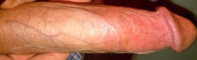 8 %c2%bc Long 6 Girth